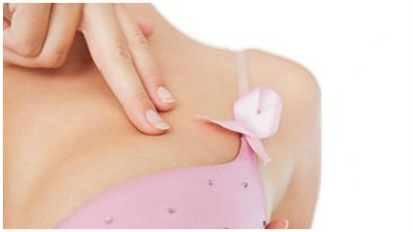 Facebook: Foto muestra indicio de cáncer de mama nunca antes registrado