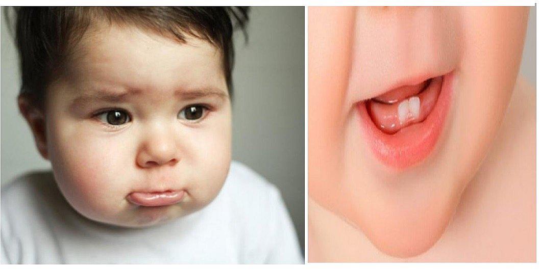 ​¿Cómo aliviar el dolor de encías de tu bebé cuando le comienza a salir un diente? (FOTOS)