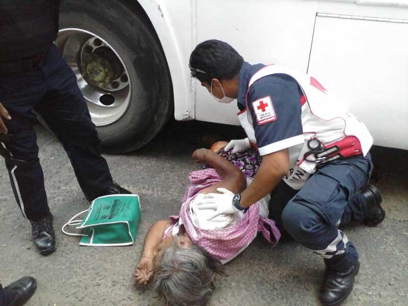 Anciana pierde su pierna en accidente