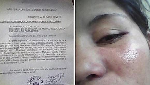 Pacasmayo: Mujer denuncia agresión por parte de su exconviviente 