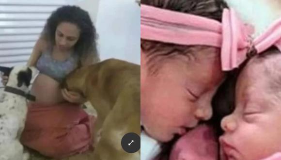 Gemelas fueron atacadas por el pitbull de sus padres en Brasil