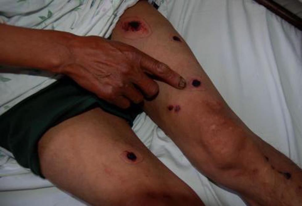 Apurímac: Protesta "pacífica" termina con 4 heridos de bala