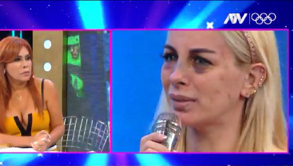 La cantante Dalia Durán contó la agresión que sufrió por parte de John Kelvin. | Foto: Magaly TV: La Firme.