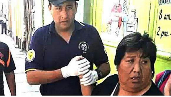 Trujillo: Mujer pierde dedo de la mano derecha tras ser impactada por espejo de un auto 