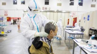 Japón combatirá al coronavirus con medicamentos contra el VIH