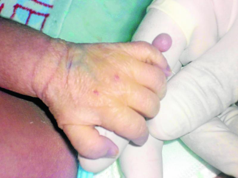 Nace con 6 dedos en mano derecha