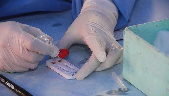 ​Arequipa adquiere 20 mil pruebas rápidas más para dotar a hospitales