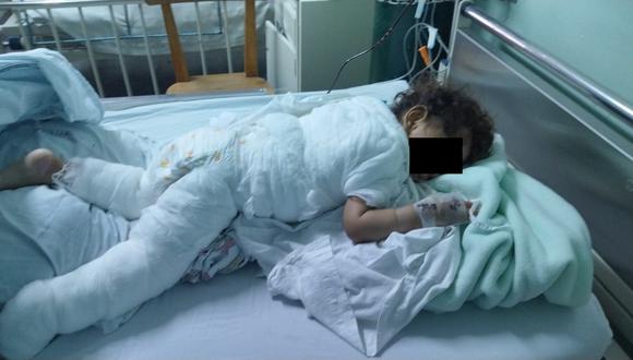 Familia de niño Johao Fabricio de 1 año y 8 meses con 80% de cuerpo quemado pide ayuda. (Foto: Difusión)