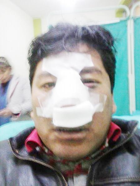 Candidato a alcalde habría agredido a comunero