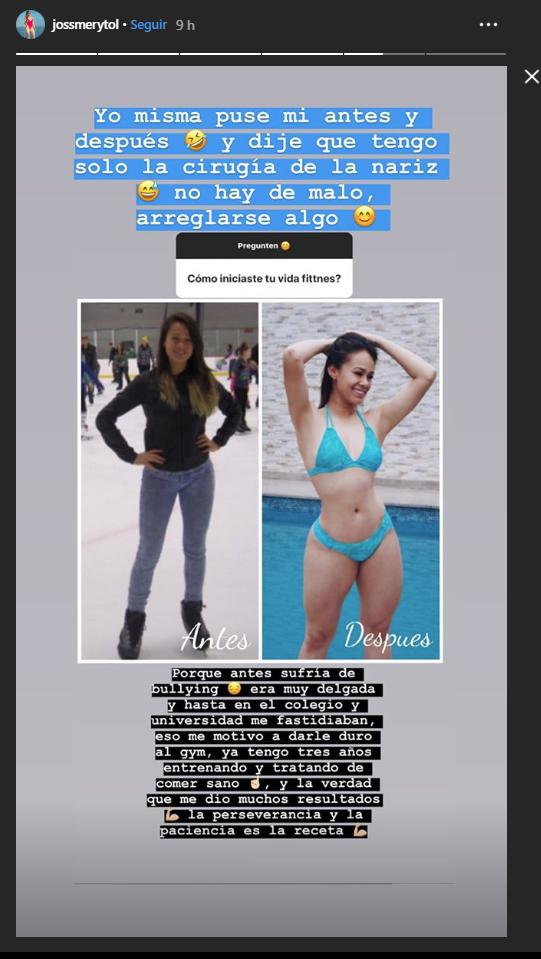 Jossmery Toledo responde aclara el tema de sus cirugías