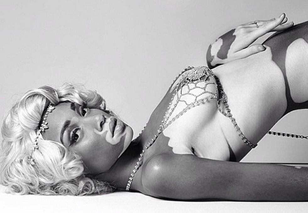 Conoce a la modelo con vitiligo que triunfa en los Estados Unidos (FOTOS)