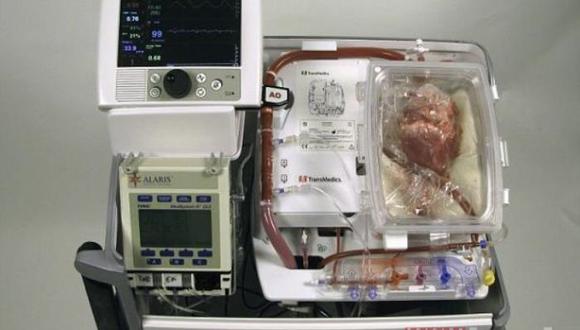 Crean dispositivo que revive corazones de personas muertas (VIDEO)