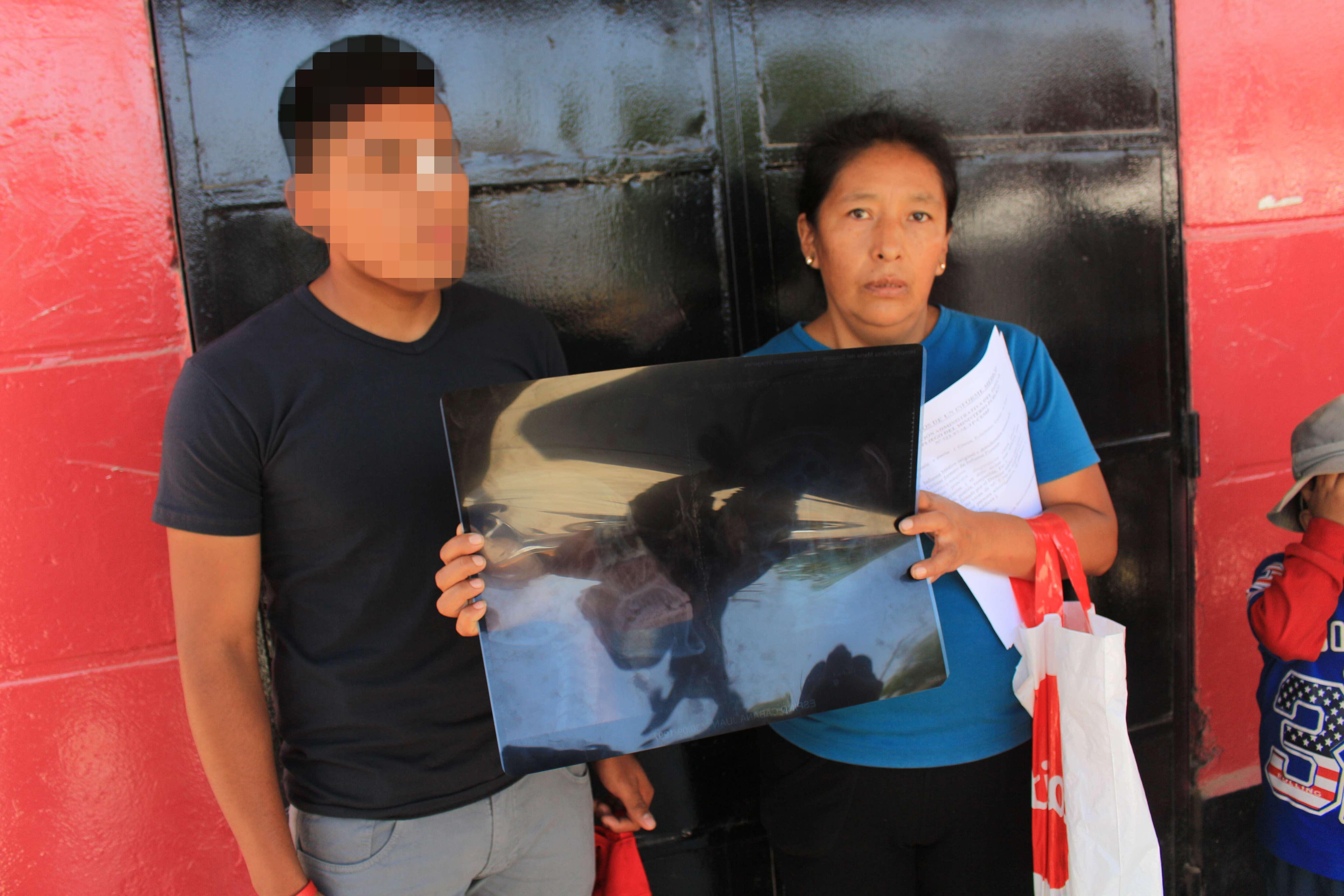 Ica: Escolar le rompe tabique a compañero por celos