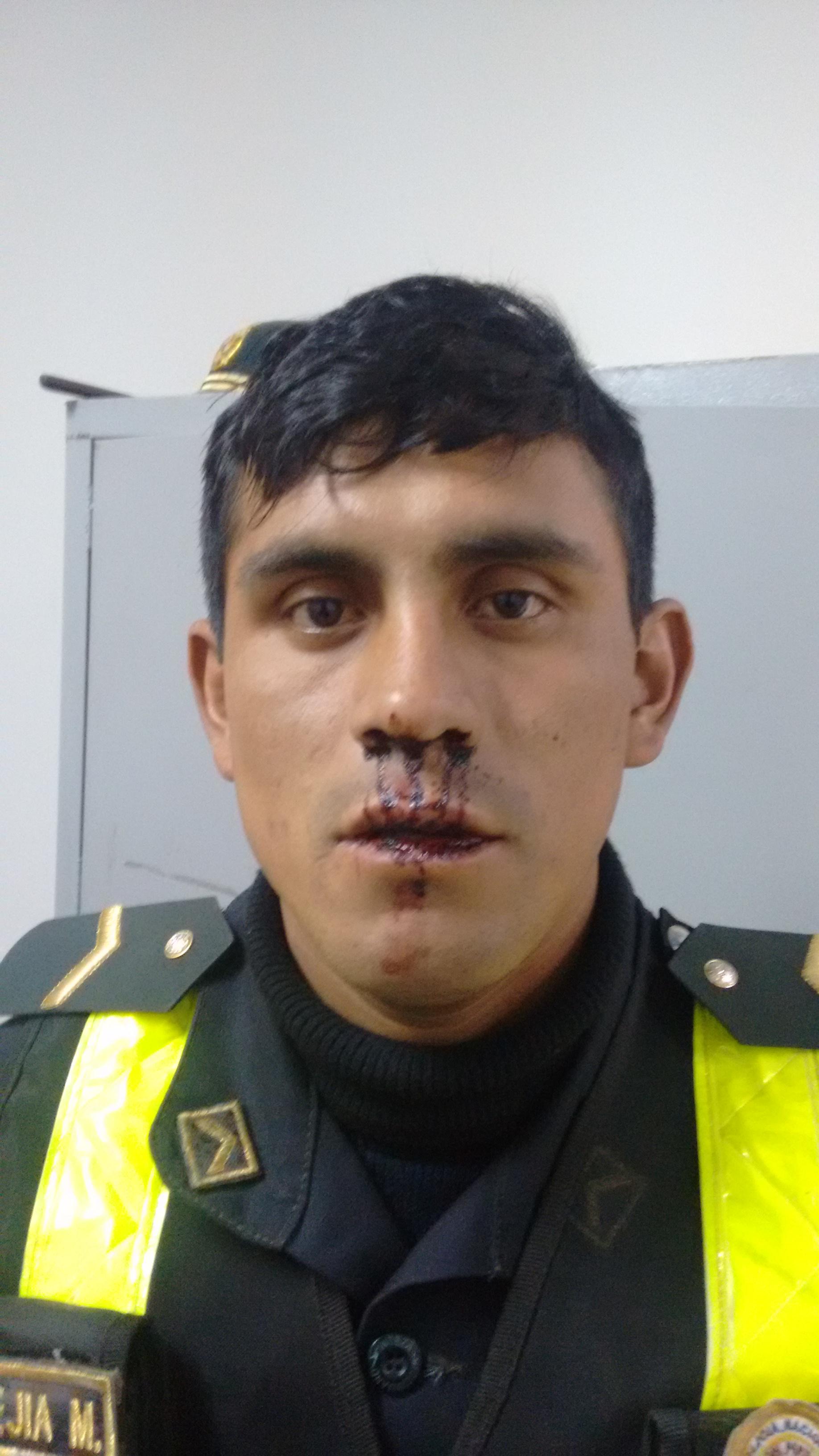 ​Sujeto ataca a policía en distrito de Santiago