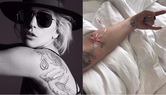 Lady Gaga: Estrella pop está hospitalizada y no participará en Rock in Rio
