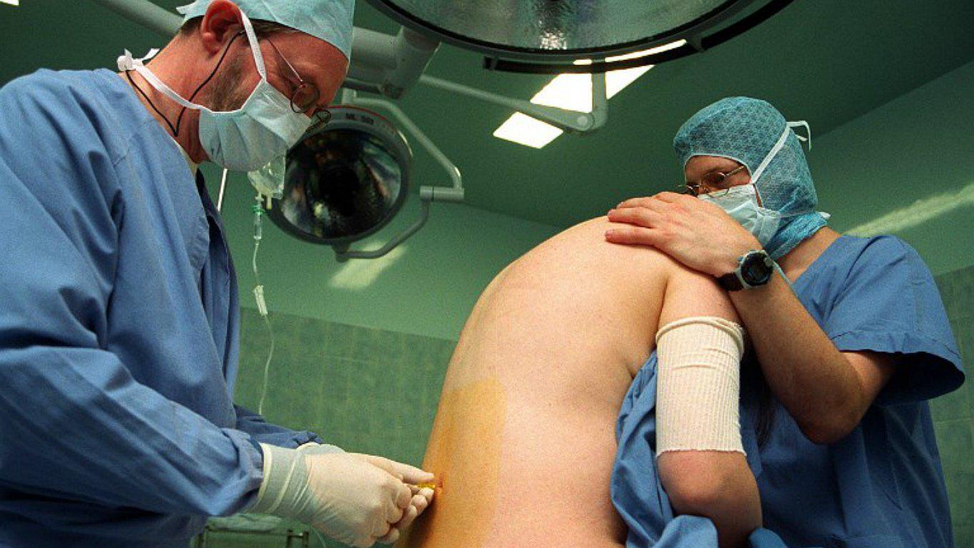 ¿Cuántas cesáreas puede tener una mujer? 