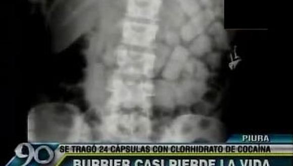 Burrier casi muere por tragar 24 condones llenos de droga