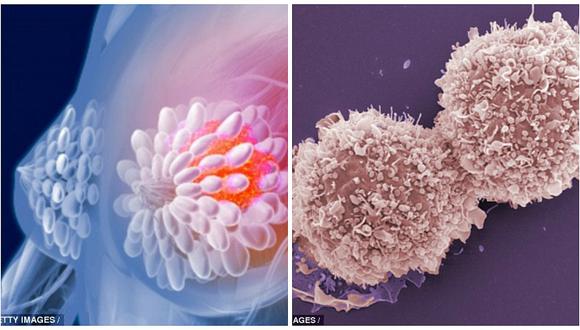 Científicos descubren forma de erradicar reaparición de cáncer de mama