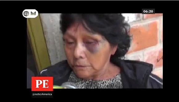 ​Delincuentes golpean brutalmente a anciana para robarle sus ahorros