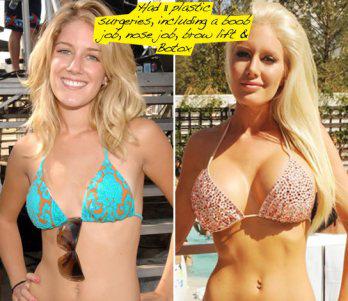 Heidi de MTV arrepentida de cirugías