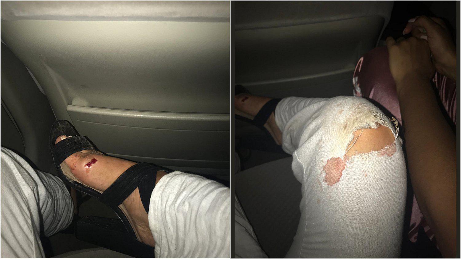 Usuaria de Uber sufre accidente tras escapar por ventana para no ser secuestrada