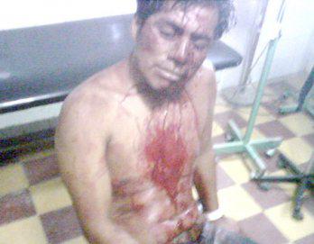 Seis heridos deja baile popular de Agua Marina