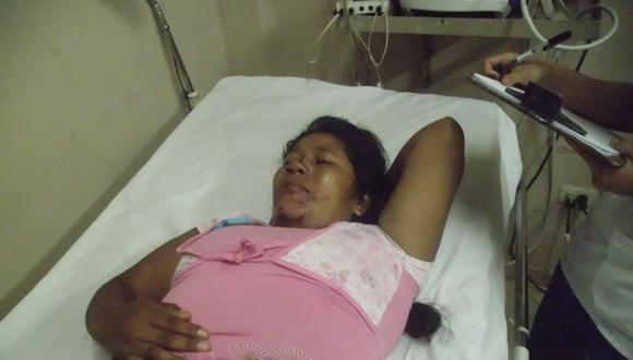 UCAYALI: Mujer se arroja de segundo piso y vive