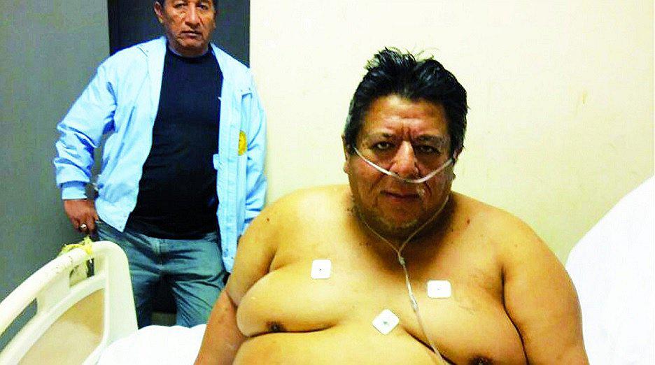 El hombre más obeso del Perú se encuentra en Tumbes