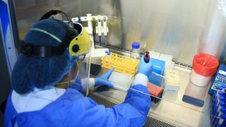 Laboratorio molecular en Junín procesará pruebas covid-19, dengue, VIH y otros