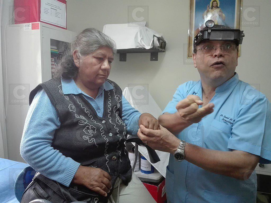 Cien casos de cáncer de piel en el 2017