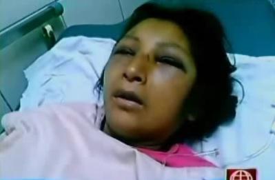 Mujer atacada con sables está embarazada 