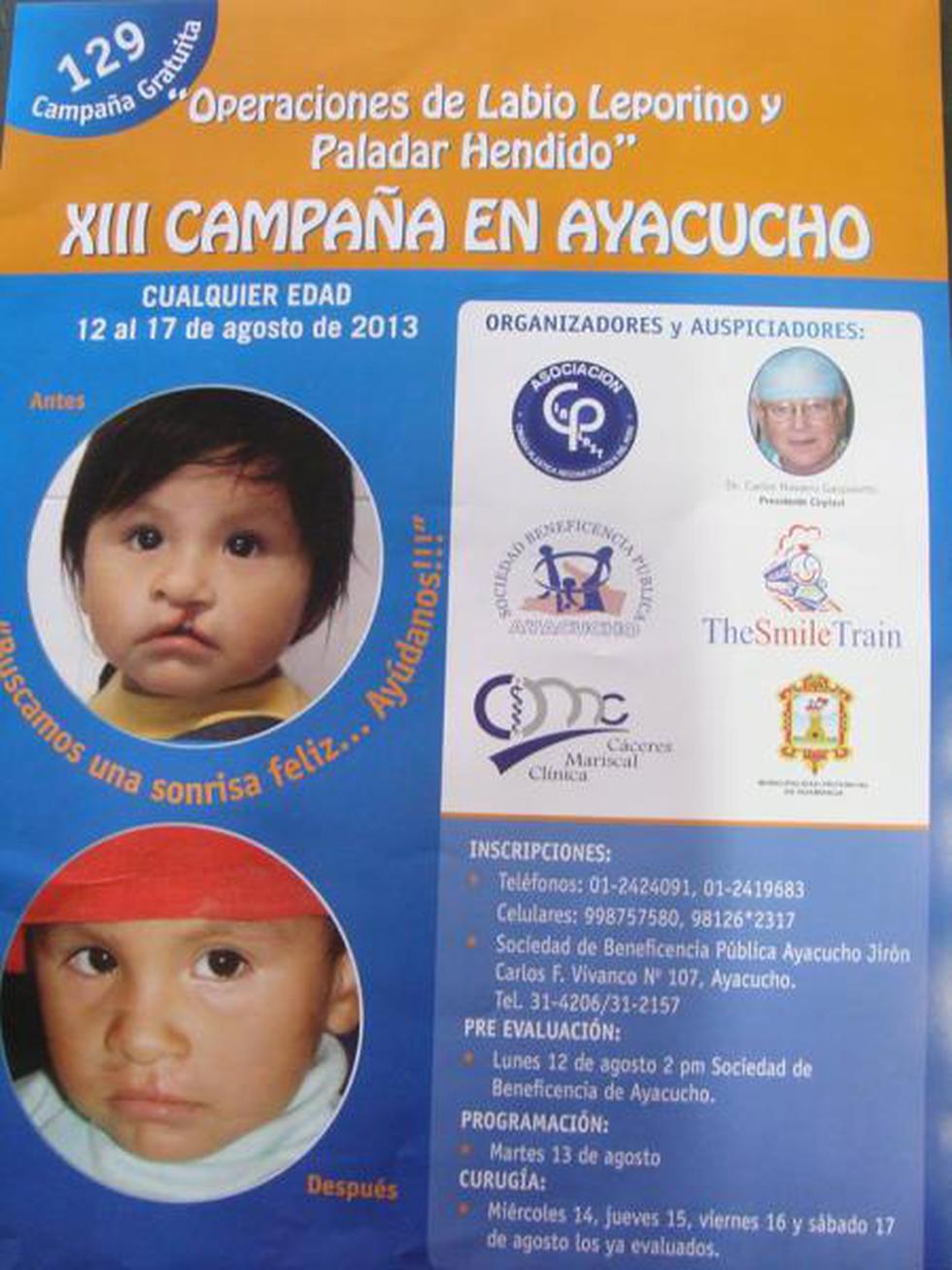 Beneficencia desarrolla campaña de operación de labio leporino