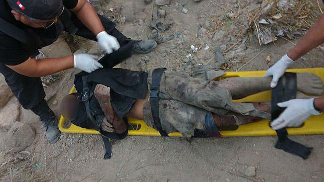 ​Arequipa: Perros arrancan oreja a indigente en quebrada