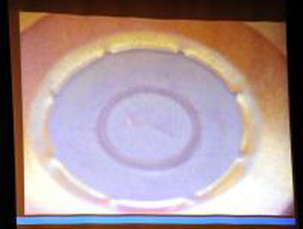 Difunden fotos de la autopsia a Michael Jackson  