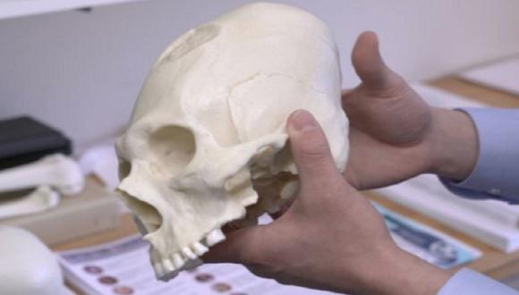 ​Arequipa: culturas antiguas modificaban los cráneos de sus bebés
