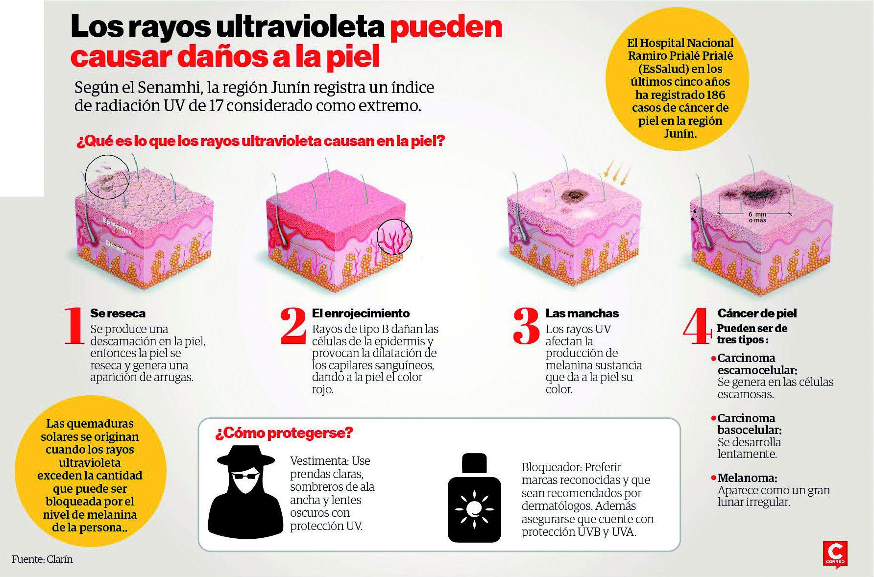 ​Junín: La región más afectada por aumento de radiación solar 