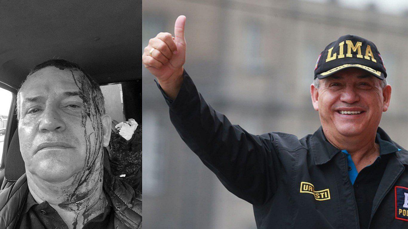 Daniel Urresti tras sufrir ataque: "En la tarde ya estoy trabajando, voy a continuar acá"