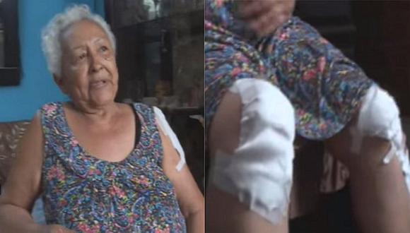 ​Anciana es arrastrada más de 30 metros por ladrón que le arranchó su monedero (VIDEO)