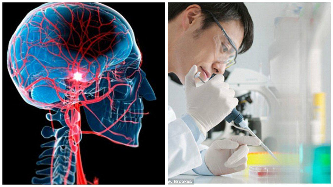 Médicos logran revertir los síntomas de un derrame cerebral