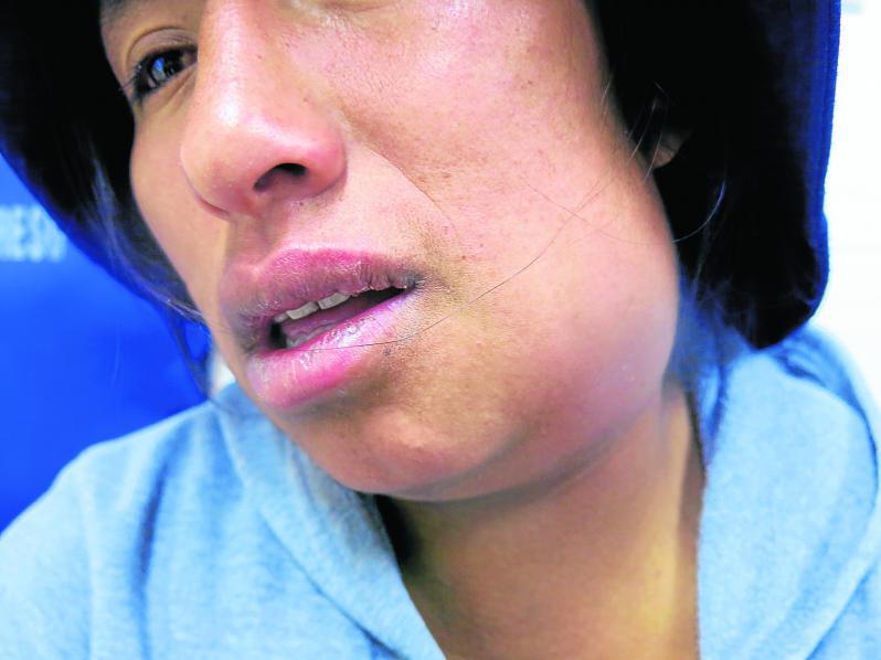 Advierten: Sacarse la muela podría  tener consecuencias fatales 