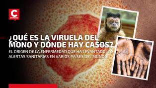 Viruela del mono: Qué es, cuál es su origen, y todo lo que debes saber de esta extraña enfermedad