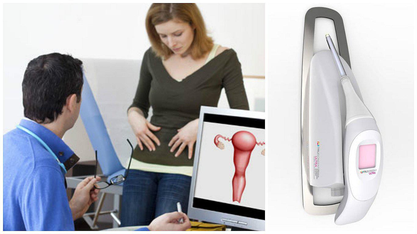 Diseñan dispositivo para detectar cáncer de cuello uterino en minutos