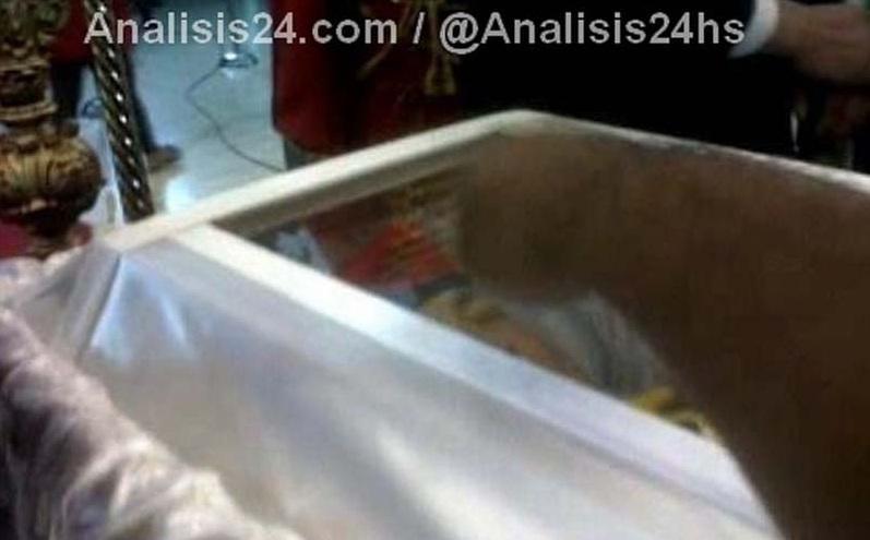 Hugo Chávez: Aparece primera imagen en su lecho de muerte