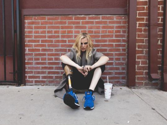 Esta joven perdió una pierna por usar tampones y alerta sobre sus peligros (VIDEO)