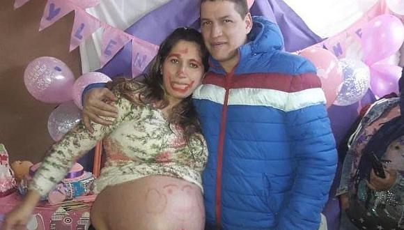 Argentina: Esperaban gemelas, pero solo le dieron un bebe