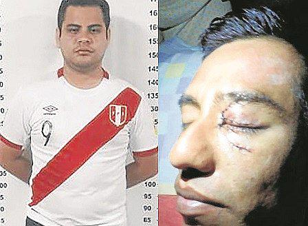 Policía resulta herido tras agresión