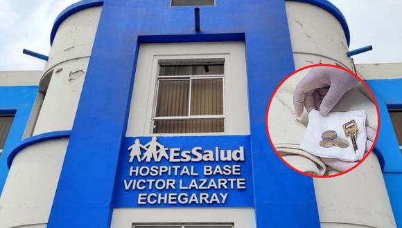 Los especialistas del Hospital Víctor Lazarte Echegaray realizaron una endoscopía gastrointestinal al adulto mayor para extraerle monedas de cinco soles, un sol, de 50 céntimos y una llave.