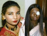 Pakistán: Entierran a mujer quemada que se suicidó ante inacción de ley