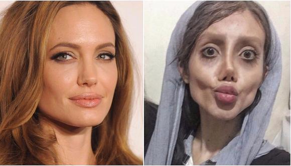 Joven se hizo 50 cirugías para parecerse a Angelina Jolie (FOTOS)