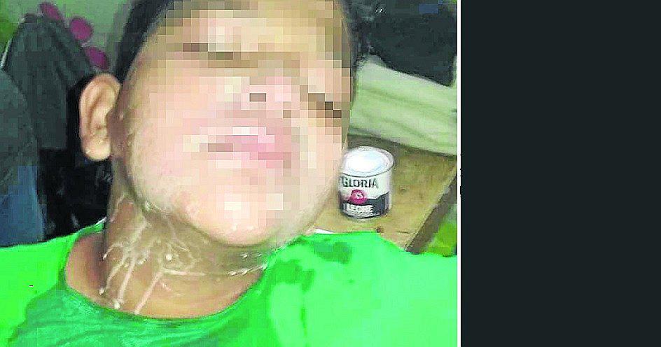 Talara: Refriegan ají en el rostro de un alumno